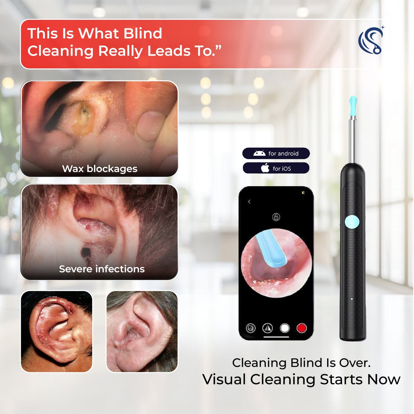 Hd Visual Ear Wax Cleaner- "Safe, Precise, Painless"